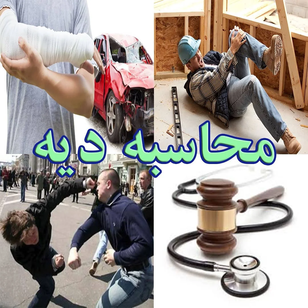 محاسبه دیه