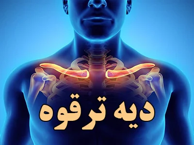 دیه خورد شدن ترقوه